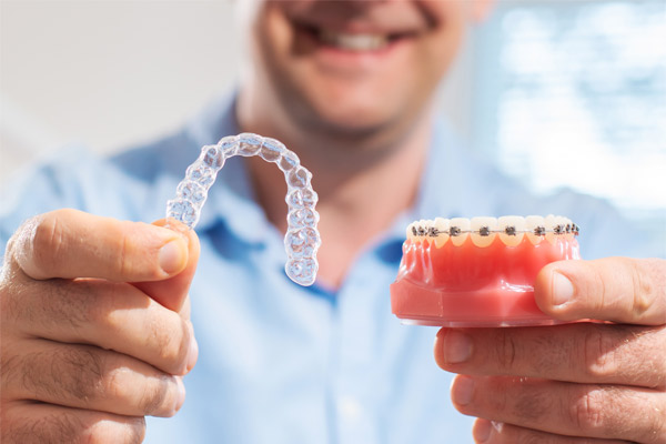 braces-or-aligners