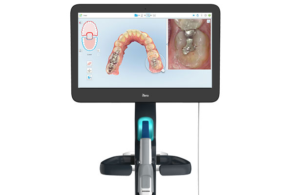 iTeroScanner6