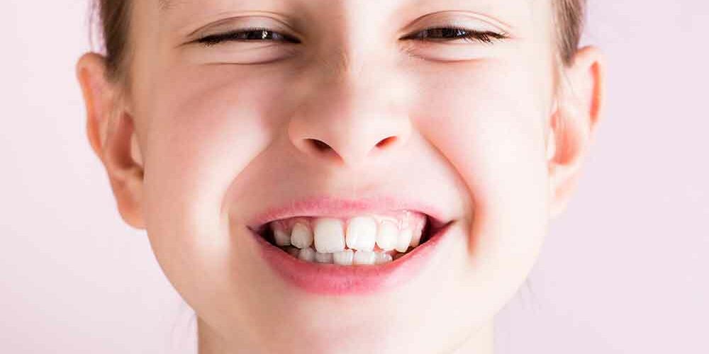 what causes crooked teeth
